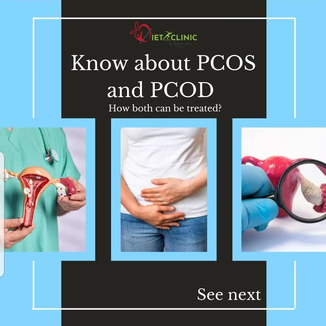 Know about PCOS and PCOD